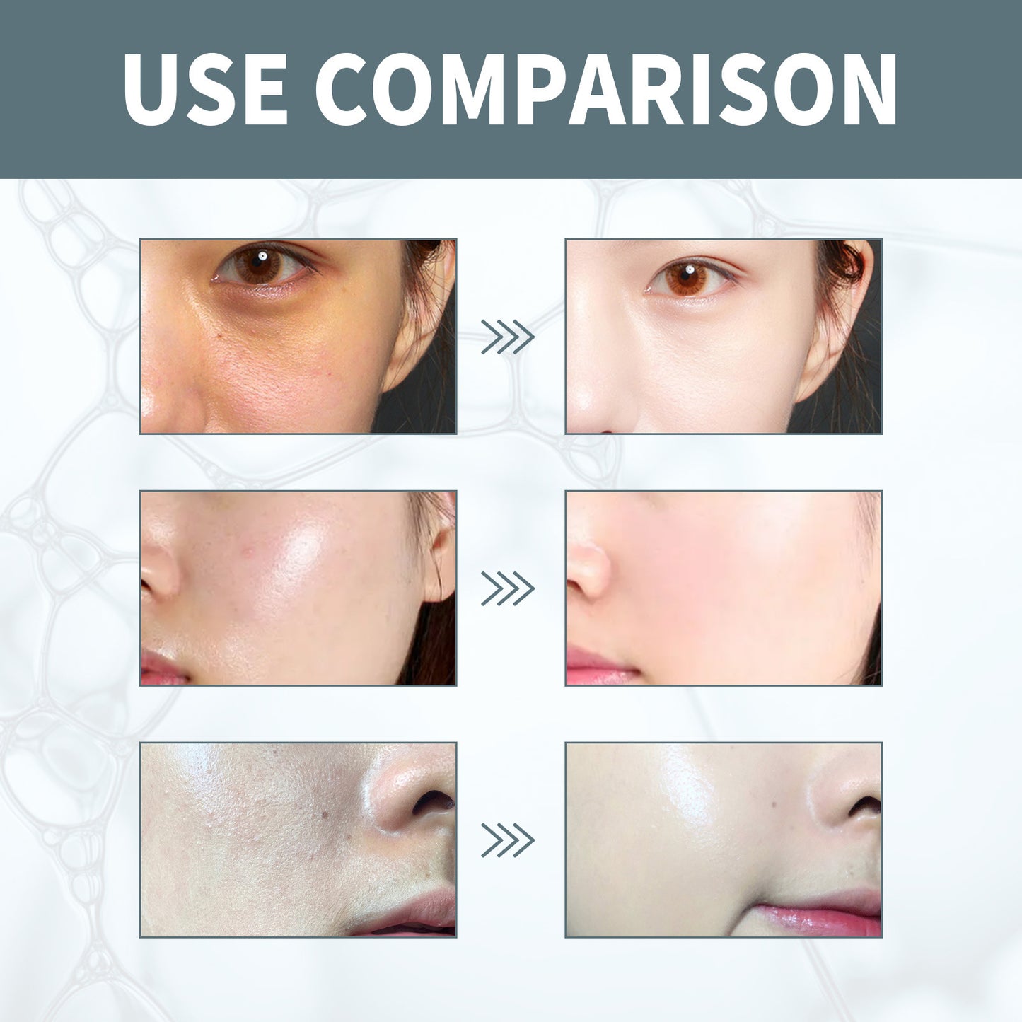Hyaluronic Acid Serum